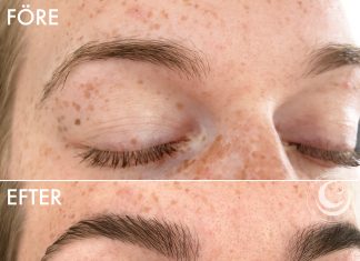 Brow lift i Uppsala på salong