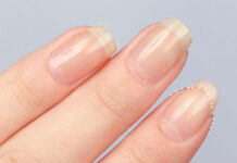 Uñas: 14 puntas para uñas estriadas, quebradizas y rayadas (cuidado de las uñas)